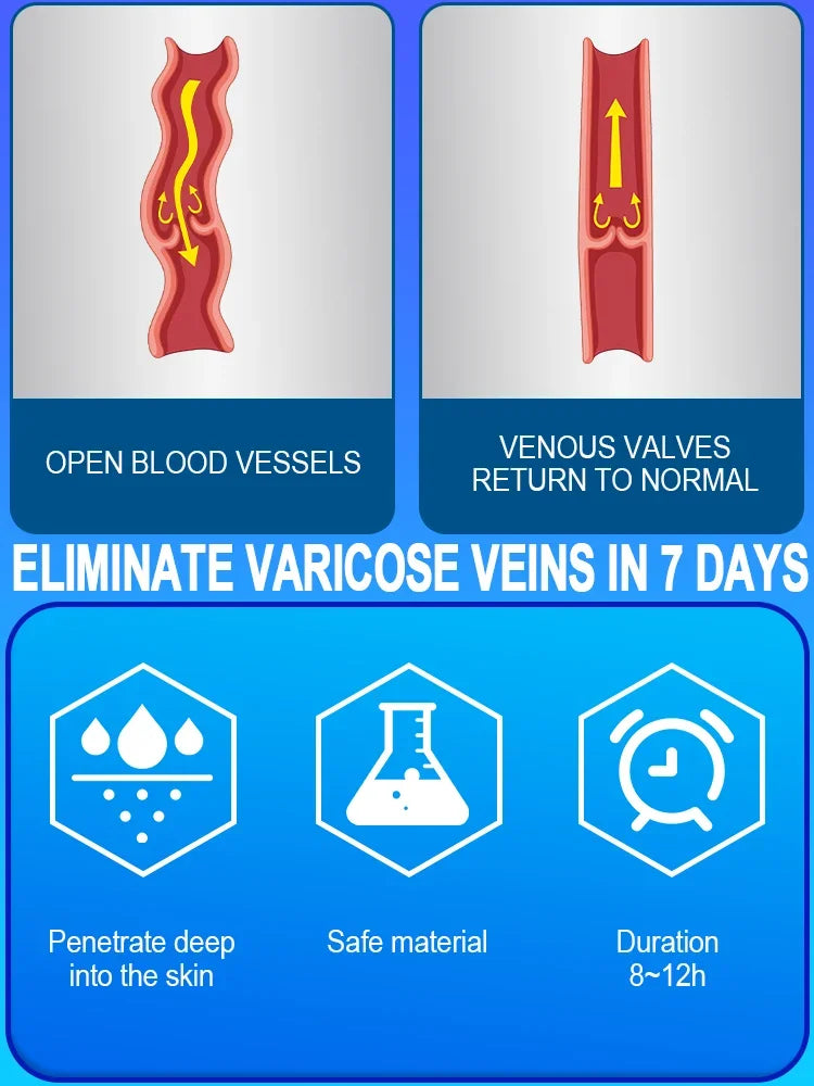 Laser Vein Therapy Treatment Veins Repair Set Hot selling