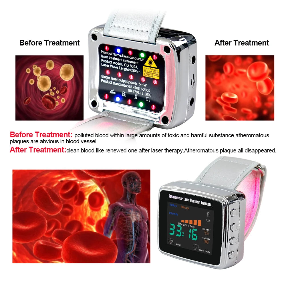 NEW Arrivals 15 Holes 650nm Laser Therapy Watch Diode LLLT Wrist Watch For Diabetes Cholesterol Hypertension Treatment Sinusitis Therapy Health Care Supplies
