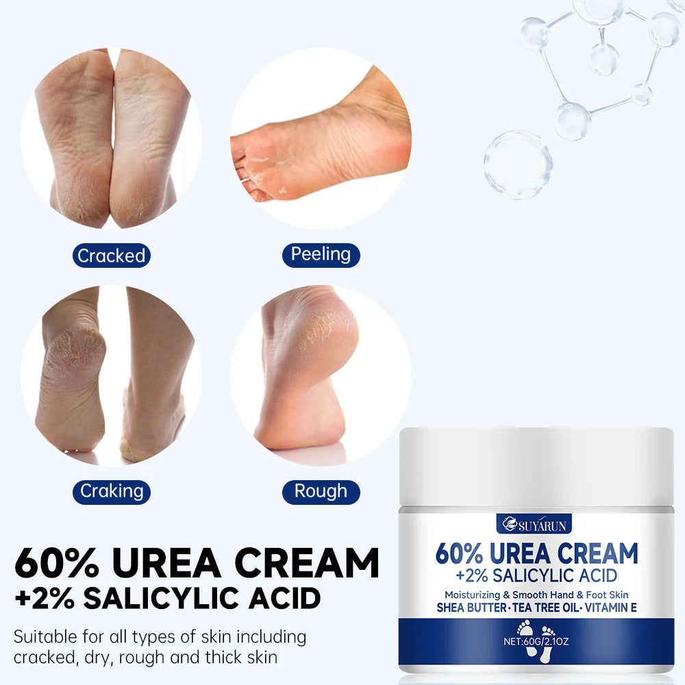 NEW 100g. 60% Urea Foot Cream for Cracked Heels & Dry Skin - Intensive Moisturizing Treatment, Callus Remover, Diabetic Foot Care.