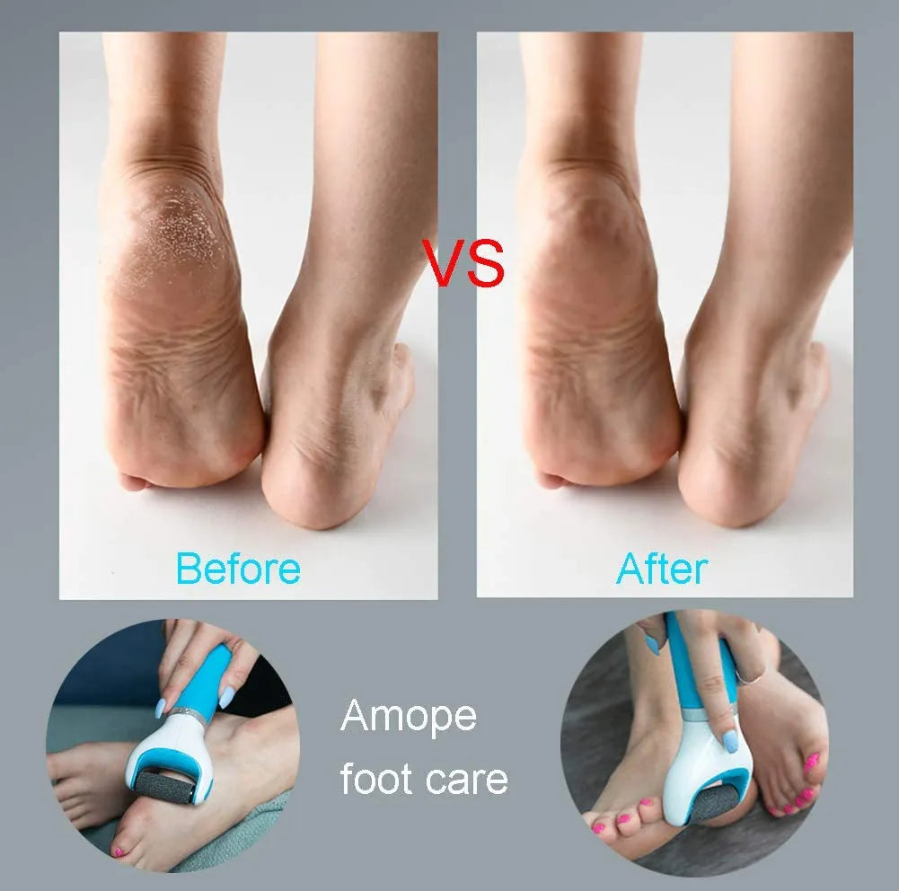 Foot Care Tool Electric Foot File Foot Callouses Dead Skin Remover Shaver Remove Dry Dead Hard Cracked Skin Safe and Painless