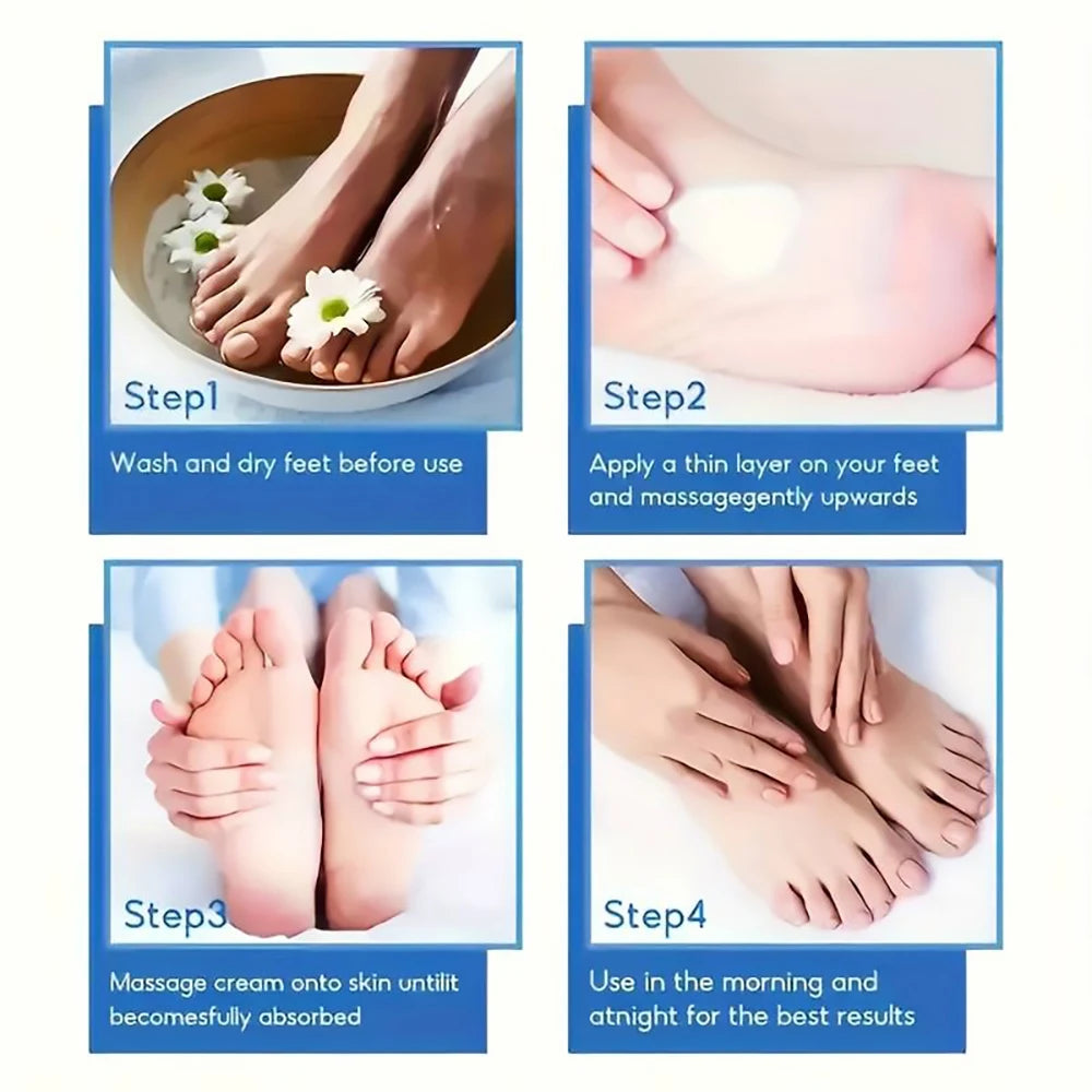 NEW 100g. 60% Urea Foot Cream for Cracked Heels & Dry Skin - Intensive Moisturizing Treatment, Callus Remover, Diabetic Foot Care.