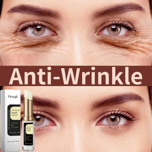 NEW 5PCS Set Snail Eye Cream Stick Collagen Fade Fine Lines Wrinkle Lightening Dark Circles Firming Eye Bags Puffiness Moisturizing Eye Cream Women Beauty Salon Supplies
