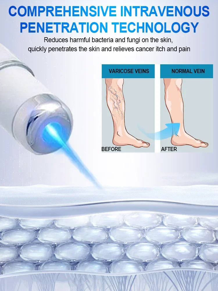 Laser Vein Therapy Treatment Veins Repair Set Hot selling