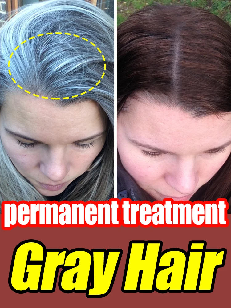 Natural Anti Gray Hair Serum - Repair White & Darkening Hair | Nourishing Hair Care Remedy