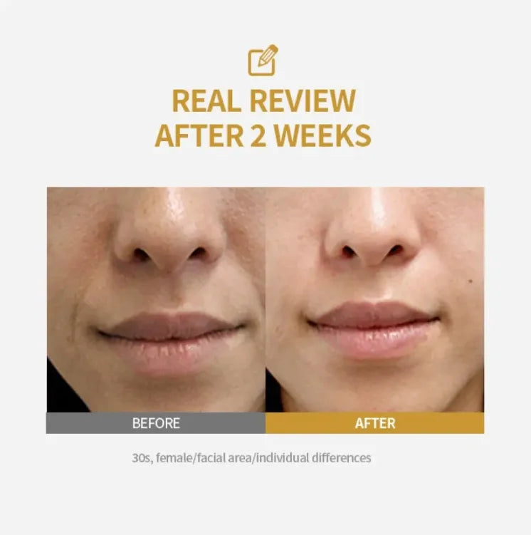 Buy 5 Get 5 Free Silk Peptide Intensive Lifting Ampoule |Anti-Aging Serum For Face With Collagen & 30 Peptide Complex  Skin Tightening & Firming Women Skin Care Supplies