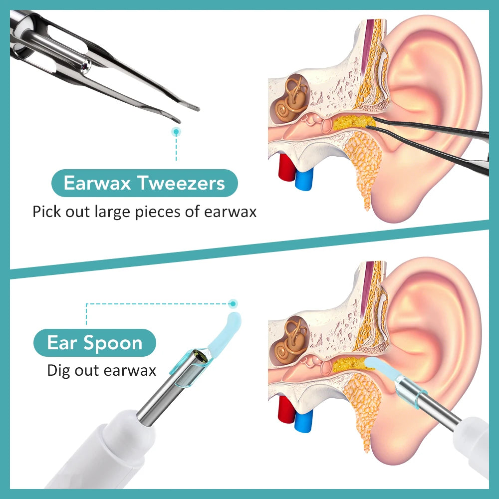NEW Set Smart Visual Ear Camera Set HD 1080P with Wi-Fi Ear Pick Endoscope Otoscope Ear Cleaner with Tweezers Ear Wax Removal Tool Ear Spoon Case Hygiene Accessories Personal Care Supplies
