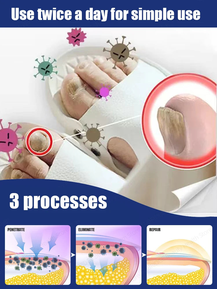 1/2 PCS Set High-Quality Blue Light Laser Therapy Broken Nails Fungus Treatment Promotes Healthy and Beautiful Nails Manicure Pedicure Accessory Sets