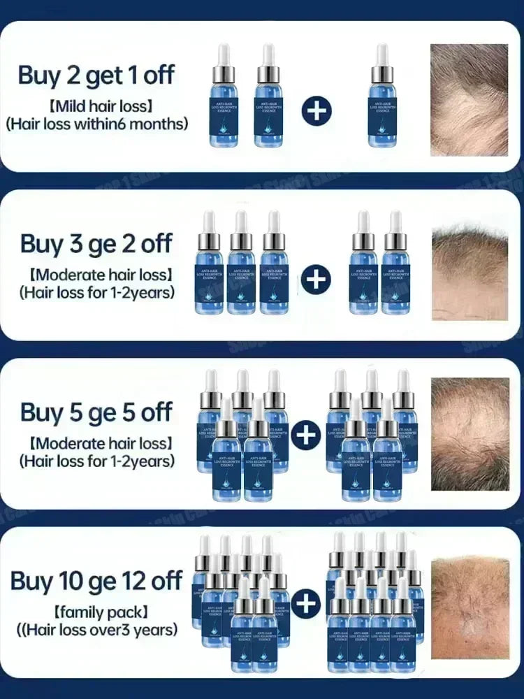 98% of Buyers Buy Again! Buy 10 Get 12 Free Hair Care Essential Oils for Thick Hair Growth Anti Loss Scalp Damaged Repairing Hair Serum Women Men Hair Care Korean Products