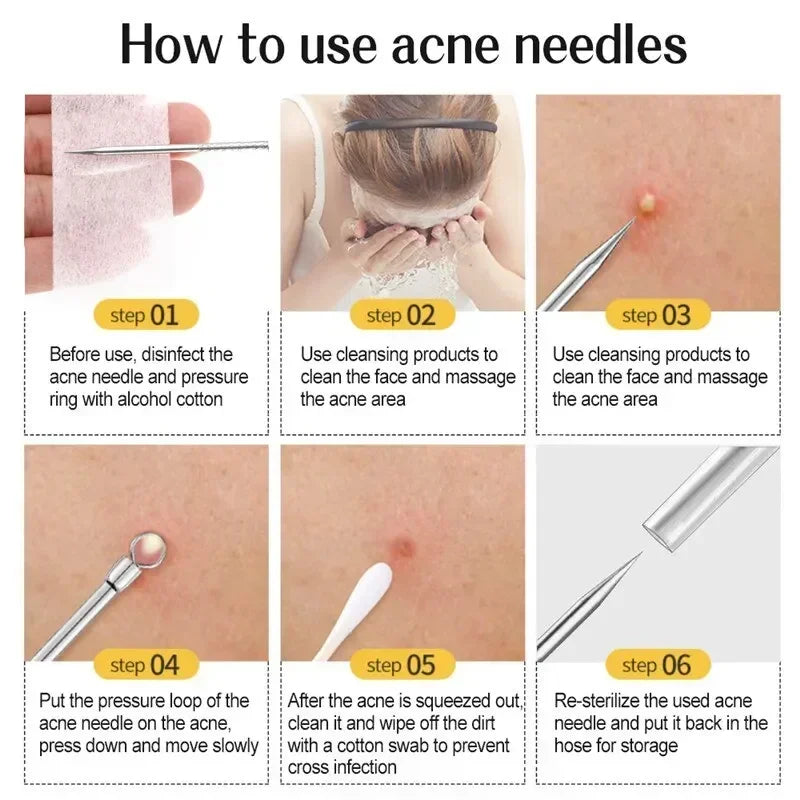 11Pcs Set Acne Pimples Blackhead Remover Clip Ultra-fine Tweezers Black Dots Blackhead Extractor Acne Needle Facial Cleaner Skin Care Tools