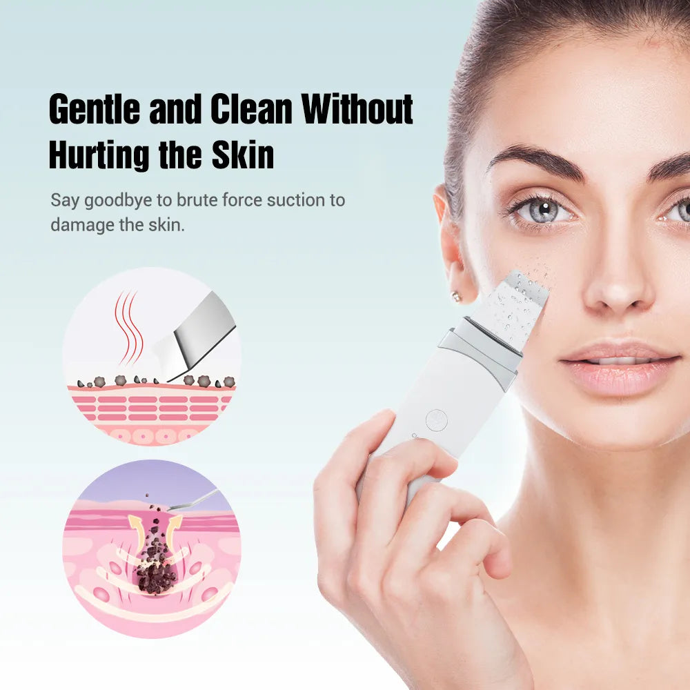 New Ultrasonic Skin Scrubber Facial Spatula Blackhead Remover Deep Face Cleaning Lift Machine Peeling Shovel Pore Cleaner