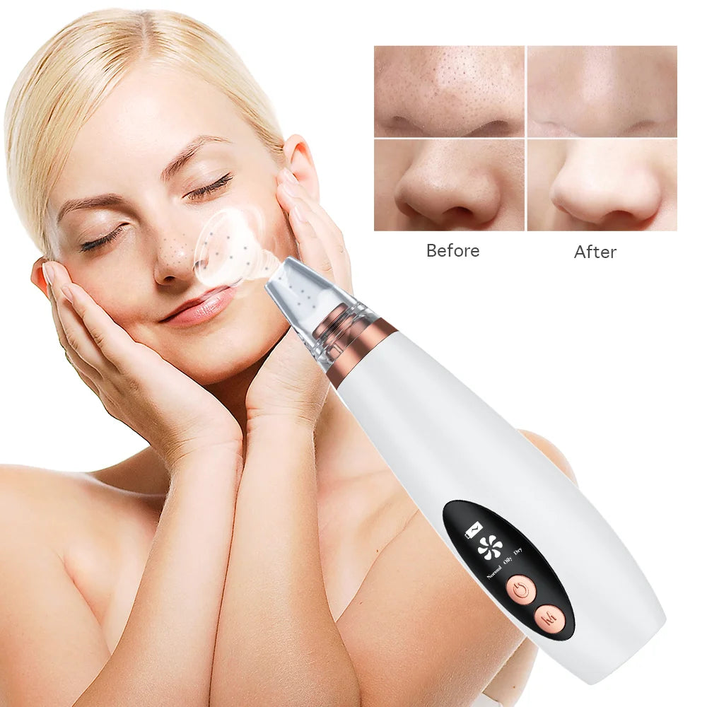 NEW Arrivals Blackhead Remover Pore Vacuum Electric Acne Extractor Kit Facial Pore Deep Cleaner USB Rechargeable Women Skin Care Tools