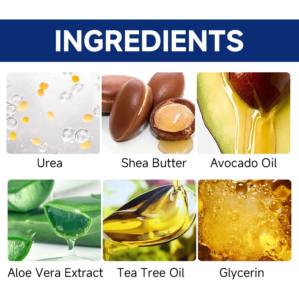 NEW 100g. 60% Urea Foot Cream for Cracked Heels & Dry Skin - Intensive Moisturizing Treatment, Callus Remover, Diabetic Foot Care.