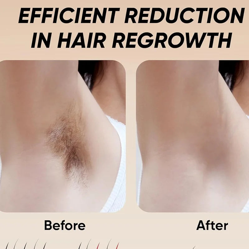 NEW IPL Touch Screen Hair Removal Epilator Laser Permanent Hair Removal Machine Face Body Electric Instrument  999999 Flashes Hair Care Supplies Skin Care Accessories