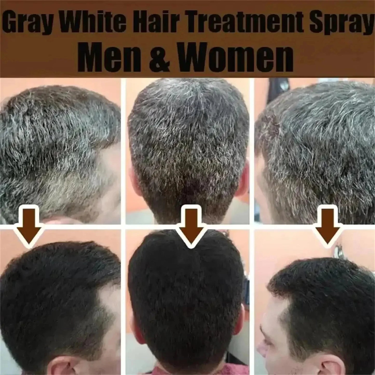 NEW Buy 3 Get 2 Free Korean Gray White Hair Treatment Serum Cover White Hair To Black Natural Color Repair Spray Anti Loss Hair Restore Healthy Hair Care Supplies
