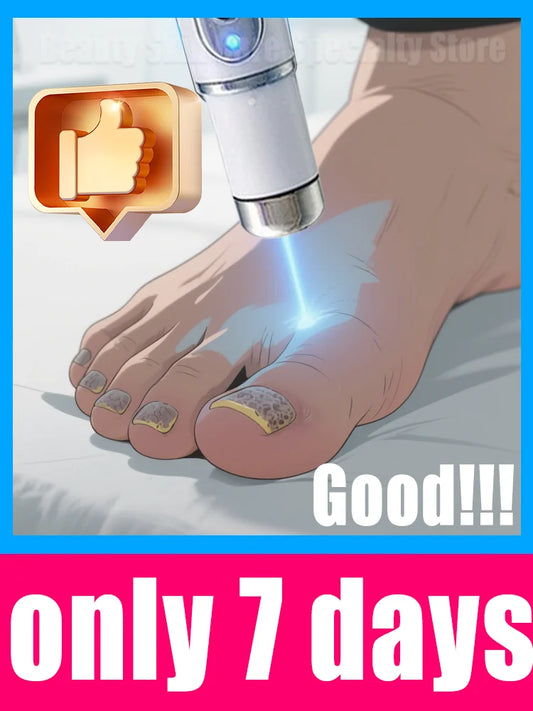 Hot Sellers: Buy 3 Get 2 Free : Nail Cleaning Tools, Blue Light Laser Tools Root Repair Onychomycosis Fungus Toenail Hands Finger Treatment Upgraded to Second Generation Women Men Skin Care Supplies