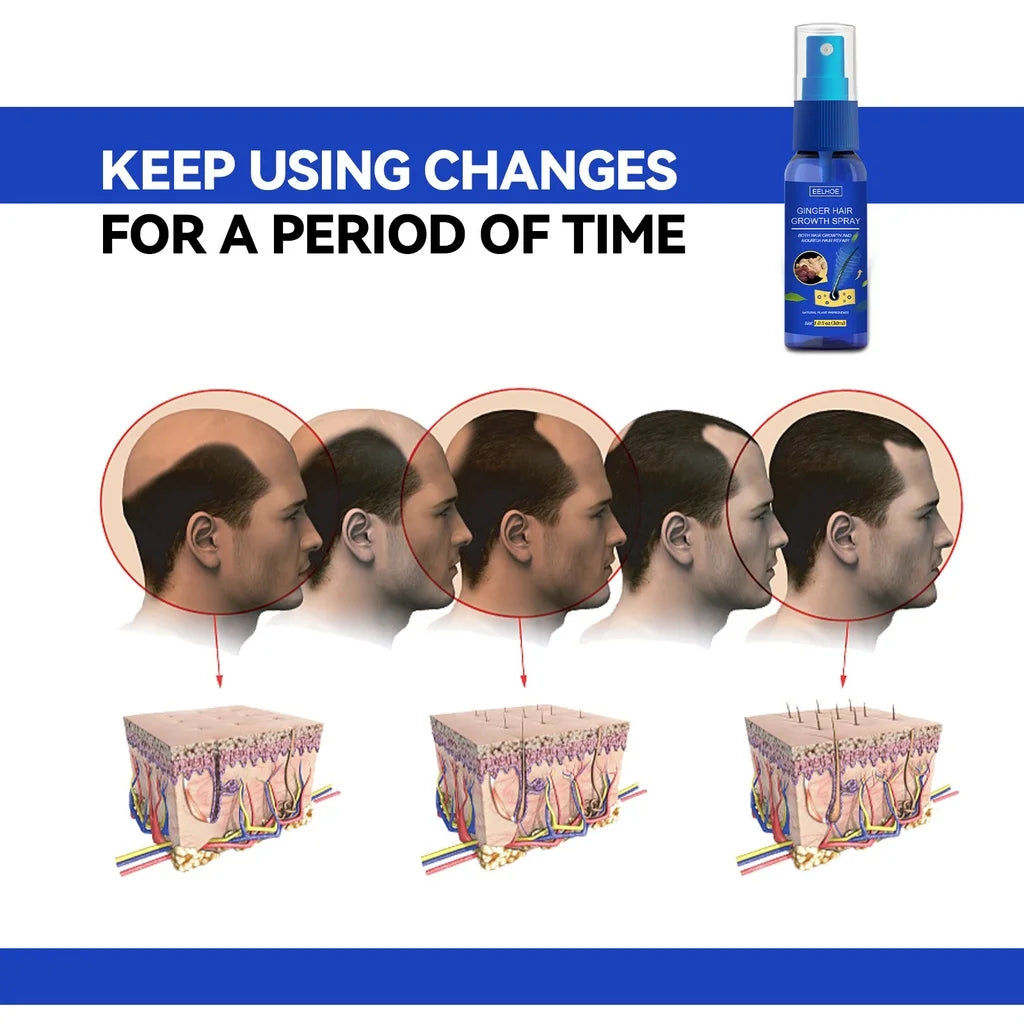 NEW Buy 5 Get 5 Free Ginger Hair Growth Spray Anti Hair Fall Hair Loss Treatment Growth Essence Oil for Men Women Hair Care Supplies