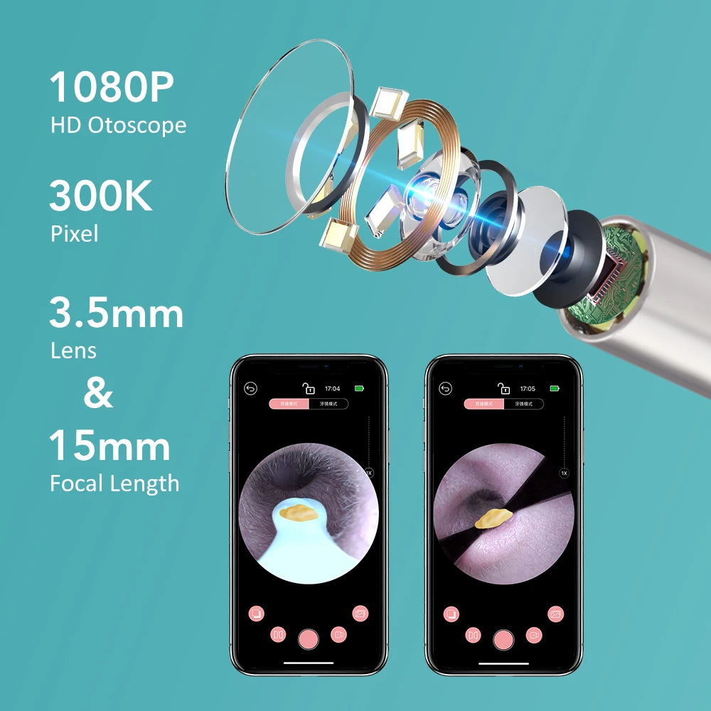 NEW Set Smart Visual Ear Camera Set HD 1080P with Wi-Fi Ear Pick Endoscope Otoscope Ear Cleaner with Tweezers Ear Wax Removal Tool Ear Spoon Case Hygiene Accessories Personal Care Supplies