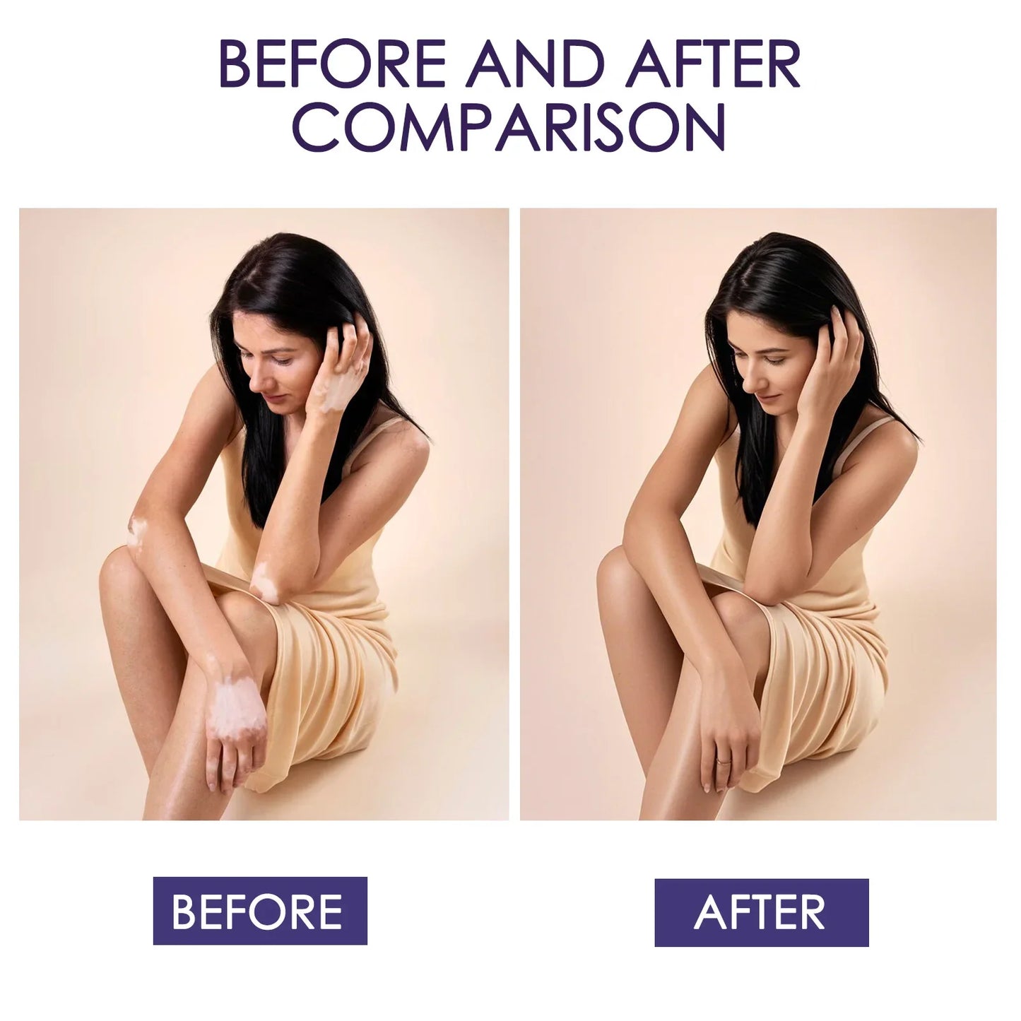 NEW 3 PCS Set Korean Tattoo Body Concealer 3 Years Shelf Life 103ML Each Make-Up, Tattoo/Scars/Spots/Sunburn High Cover Cream Long Lasting Waterproof Face Foundation