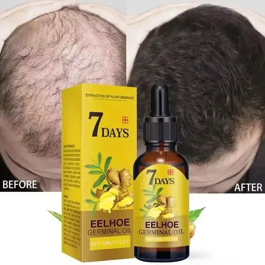 5 PCS Set 200ml 7 Days Fast Ginger Hair Growth Serum Anti-Loss Hair Regrowth Product Repair Nourish Damaged Hairs Scalp Care Oil For Women Men Hair Care Korean Supplies