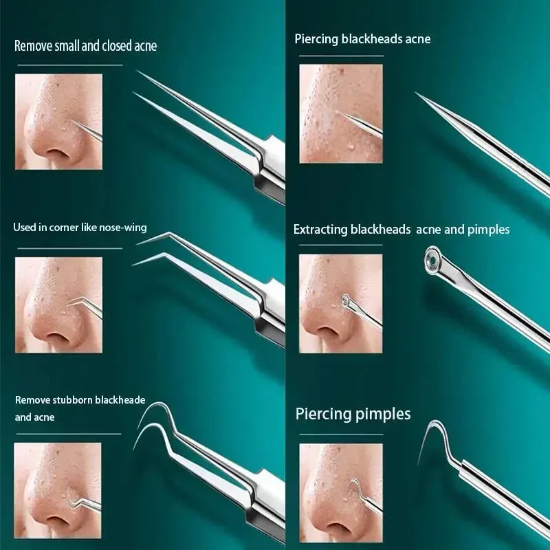 NEW Arrivals 11PCS Set  Ingrown Hair Tweezers Acne Blackhead Removal Needles Black Dots Cleaner Pore Cleaner Deep Cleansing Face Skin Care Tools Face Care Accessories Skin Care Supplies