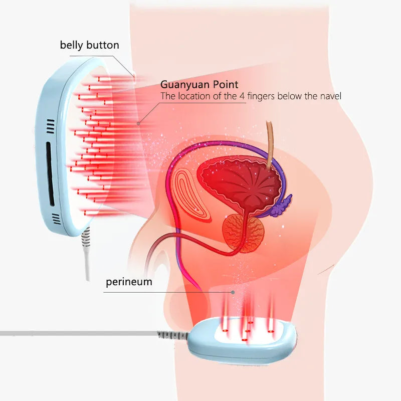 Household Prostate Gland laser treatment laser ablation of  prostate tissue Prostate Massager