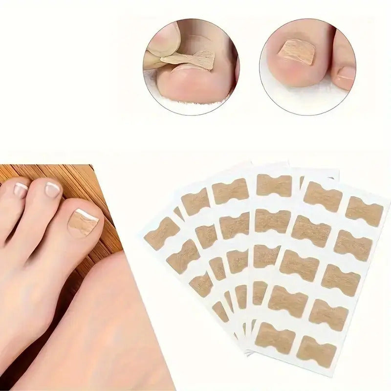 NEW Arrivals 160 PCS 16 Sheets Set Glue-On Toenail Correction Tapes - Instant Cover for Toenails, Hidden Holes & Bends, Nail Cover Strips, Easy Cut-to-Fit (No Sensitive Glue), for Sensitive Light Beige