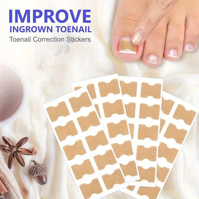 NEW Arrivals 160 PCS 16 Sheets Set Glue-On Toenail Correction Tapes - Instant Cover for Toenails, Hidden Holes & Bends, Nail Cover Strips, Easy Cut-to-Fit (No Sensitive Glue), for Sensitive Light Beige