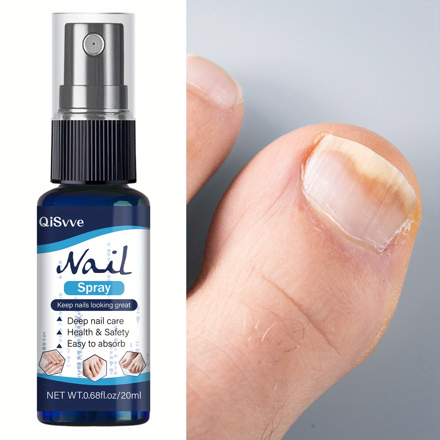 For Day Night Nail Strengthen Care Spray Healthy Hand Nails And Toenails Moisturizing Liquid Cream Feet Nail Cuticle Care Oils Supplies Comprehensive Nail Care Serum Plant Extract Formula for Yellow Finger Nails And Toe Nails
