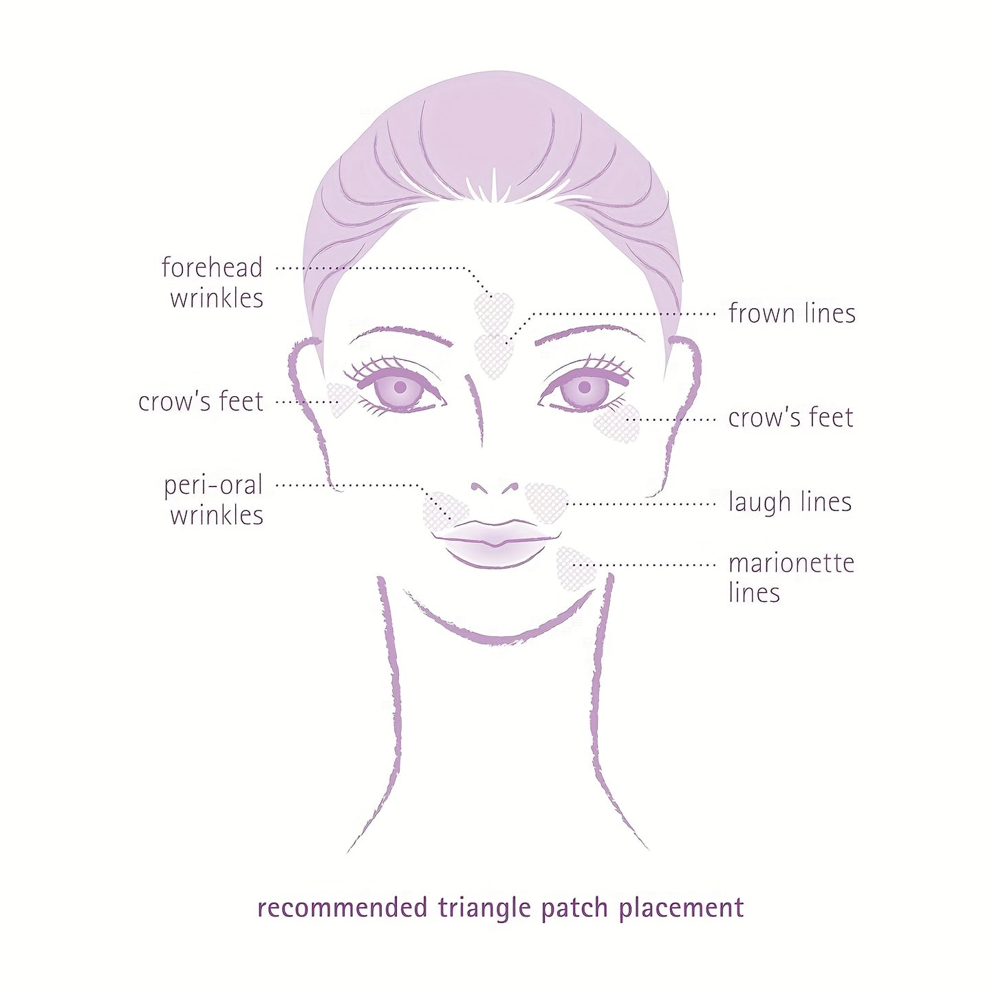 90 PCS Set of Facial And Forehead Wrinkle Patches - Small Patches for The Eyes, Mouth, And Forehead - Triangular Non- Facial Tape Ideal for Treating Frown Lines, Crow's Feet, And Fine Lines